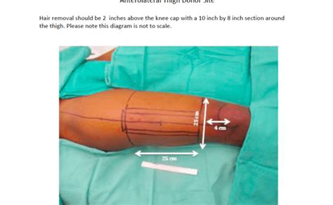 ftm bottom surgery result pictures|Phalloplasty Archives .